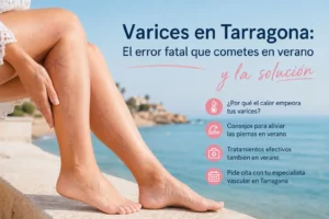 verano-y-varices