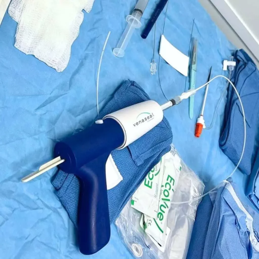 Eliminación de tus varices Venaseal